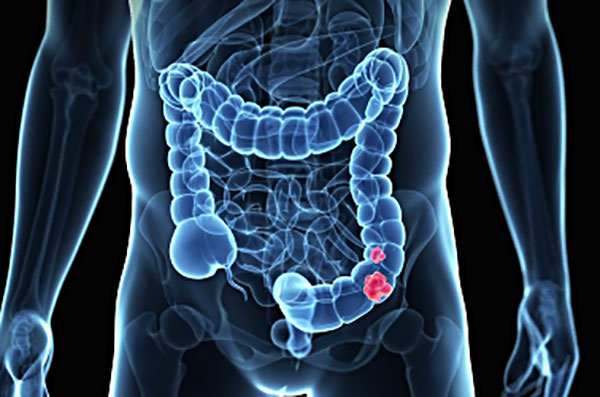 colon-health-and-body-ecology