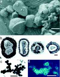 causes of aging nanobacteria causes of aging nanobacteria